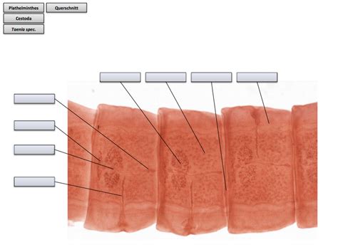 Schaubild Cestoda Taenia Spec Querschnitt Quizlet