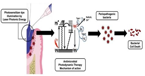 Pharmaceutics Free Full Text Effectiveness Of Antimicrobial Photodynamic Therapy In The