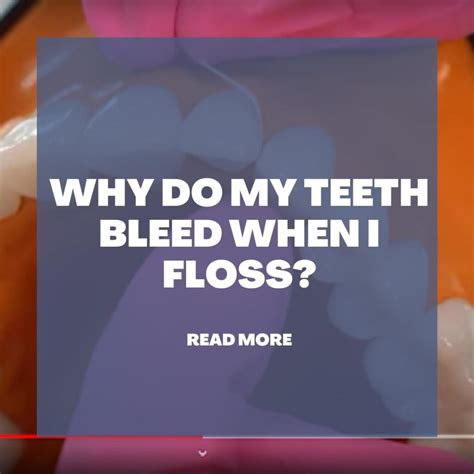 Why Do My Teeth Bleed When I Floss Dental Pickup