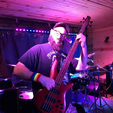 These hickeys removal tricks work in less than ten minutes 10