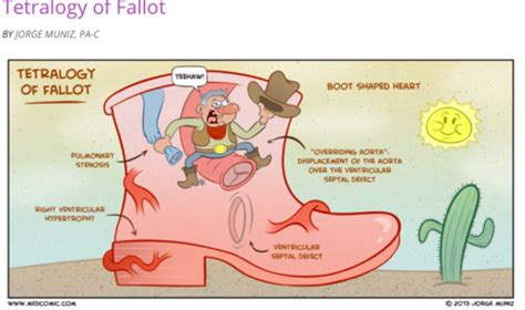 Peds Cardiology Flashcards Quizlet