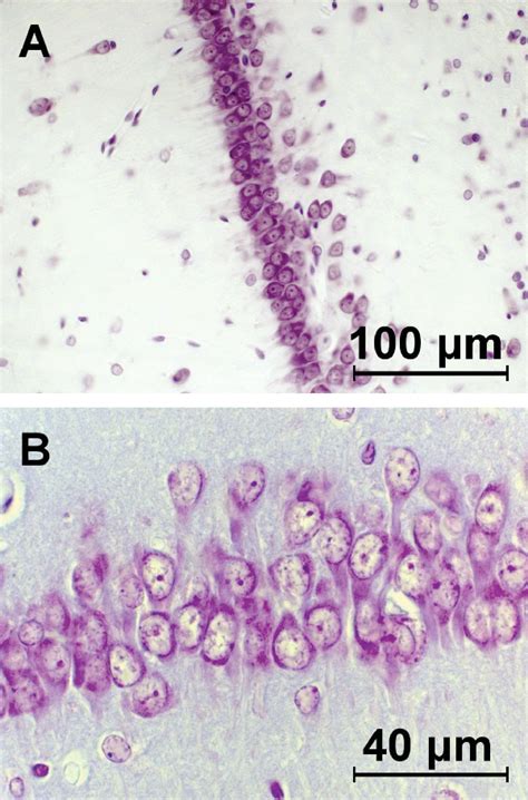 Photomicrographs Of The Hippocampus CA1 Field Stained With Cresyl