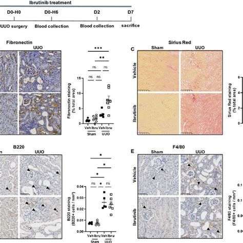 Ibrutinib Promotes Renal Fibrosis After Unilateral Ureteric Obstruction