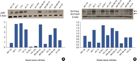 Leptin And Leptin Receptor Ob R Expression In Various Breast Cancer