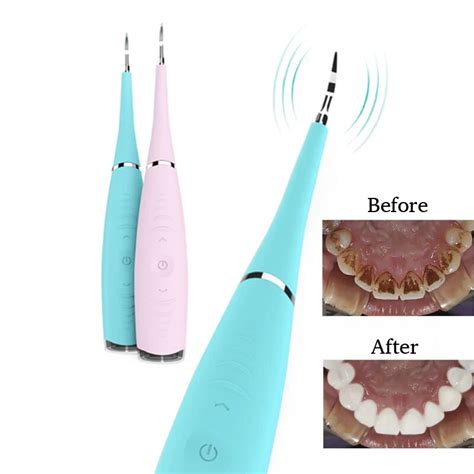 Teeth whitening Home Use Tooth Stain Remover Tartar Teeth Stains ...