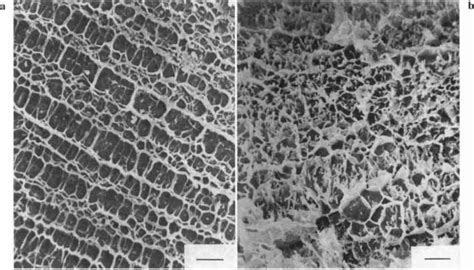 Scanning Electron Microscopy Observation Of The Fibrin Clot Obtained Download Scientific