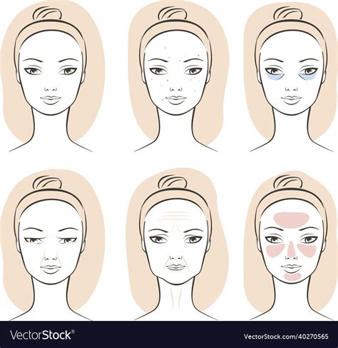 Facial skin problems Royalty Free Vector Image