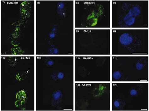 Confocal laser scanning microscope 0n7 µm optical sections through ...