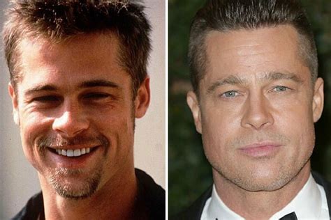 Brad Pitt Before And After Plastic Surgery