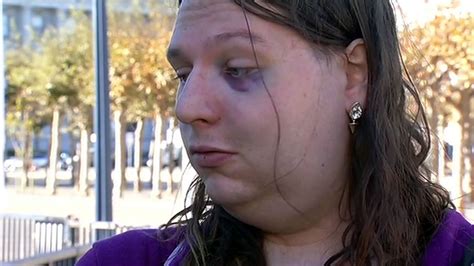 Police Investigate After Transgender Woman Samantha Hulsey Attacked In San Francisco For Second