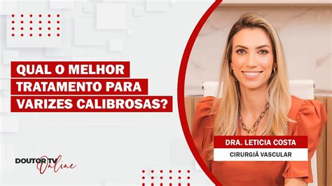 Qual O Melhor Tratamento Para Varizes Calibrosas YouTube