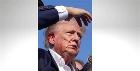 Trump Con Sangre Visible En Su Oreja Derecha Evacuado De Mitin Diario