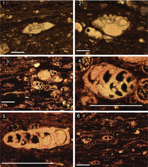 Photomicrographs Of Benthic Foraminifera From Thin Section Using