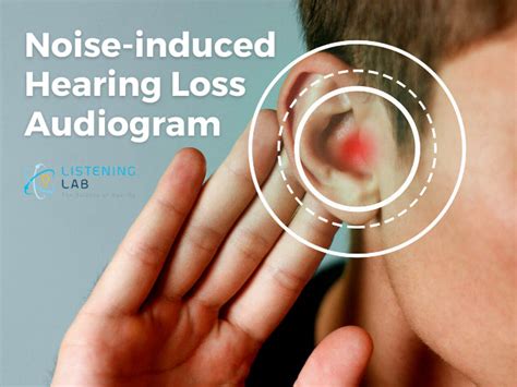 Noise Induced Hearing Loss Audiogram Listening Lab Malaysia