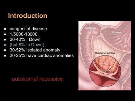 Duodenal Atresia