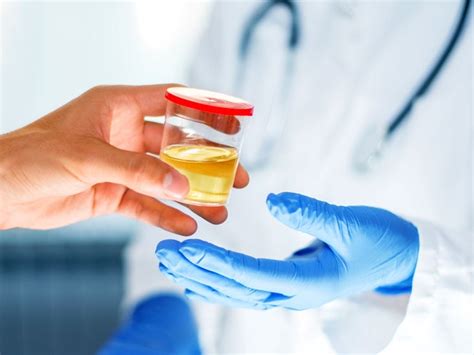 Microalbuminuria Test Purpose Procedure And Results