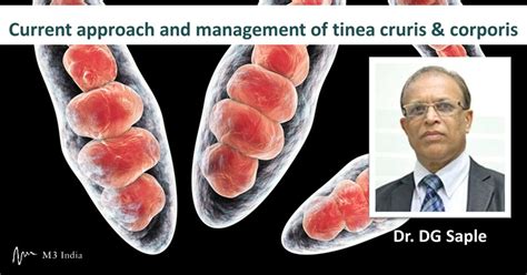 Jock Itch Tinea Cruris Causes Risk Factors Signs