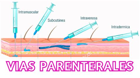 Vias De Adm Parenteral SOLOLEARN