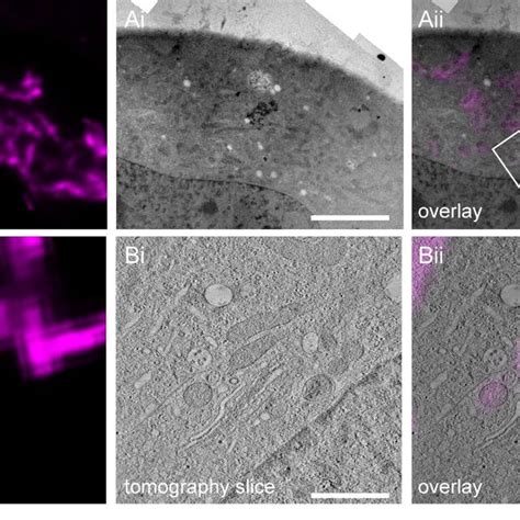 In Resin Clem After Sample Preparation By High Pressure Freezing And