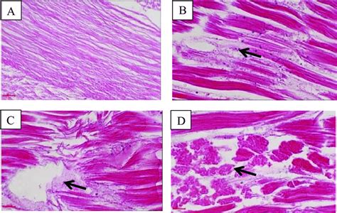 Sections Of The Muscle Of C Cf Babaulti Infected With A A Veronii Download Scientific