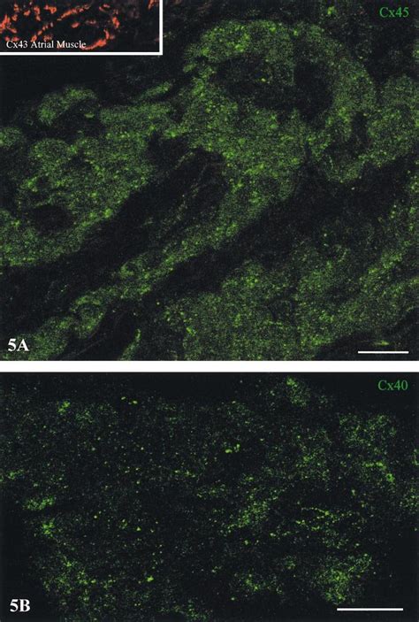 Confocal Micrographs Showing Localization Of Cx45 A And Cx40 B Gap