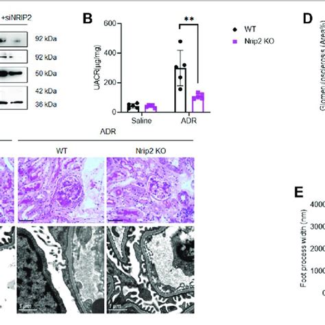 Loss Of Nrip Reduced Adr Induced Podocyte Injury And Proteinuria In