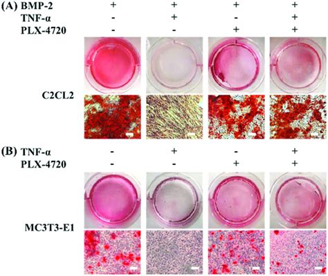 Alizarin Red S Staining Of Differentiated Osteogenic Cells To Determine