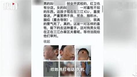 4岁女童疑遭继母殴打浑身是伤？目前仍在icu救治！嫌疑人已被关押澎湃号·媒体澎湃新闻 The Paper