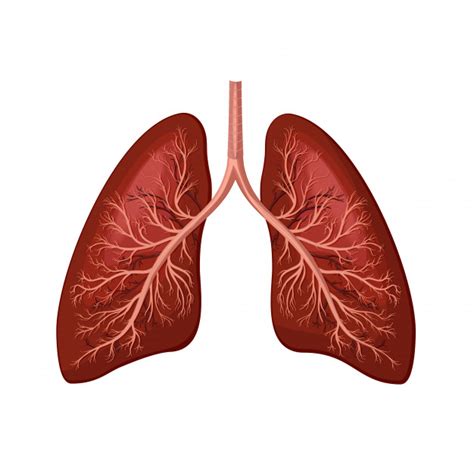 Embolización de arteria Bronquiales para tratamiento de Hemoptisis