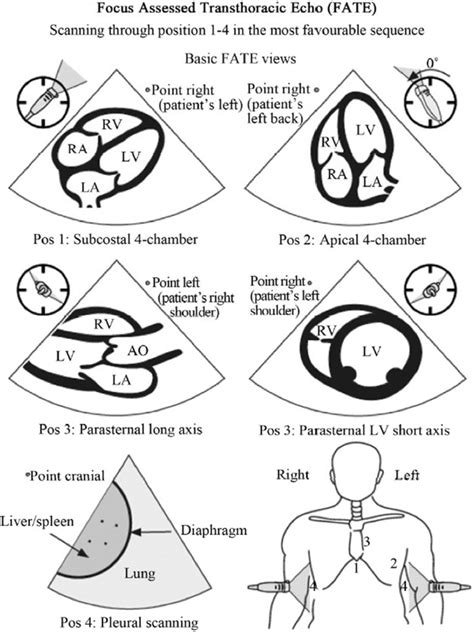 The Basic Four Views Of Fate Focus Assessed Transthoracic