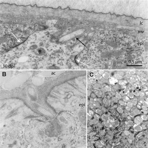 Ventral nerve cord. a Intraepidermal nerve cord in early stages ...