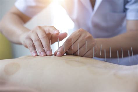 Acupuncture For Sciatica Pickering On Active Integrative Medicine