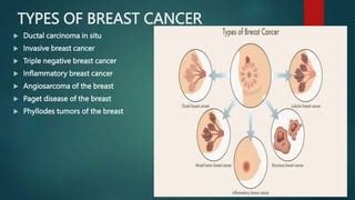 Breast Cancer | PPTX