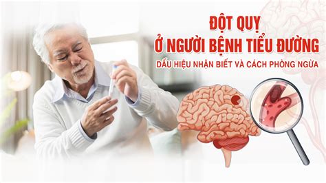 Đột Quỵ ở Người Bệnh Tiểu đường Dấu Hiệu Nhận Biết Và Cách Phòng Ngừa