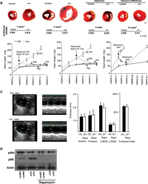 Smooth Muscle Protein 22 Mediated Deletion Of Tsc1 Results In Cardiac