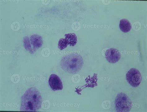 Chromosomes in the nucleus of a cell 12957780 Stock Photo at Vecteezy