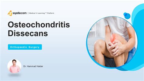 Osteochondritis Dissicens Introduction Orthopedic Surgery Lecture