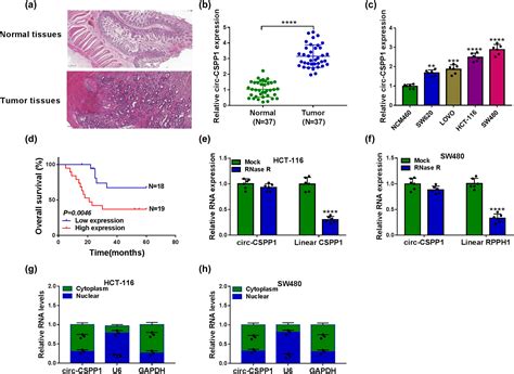 Identification Of Circrna Circ Cspp As A Potent Driver Of Colorectal