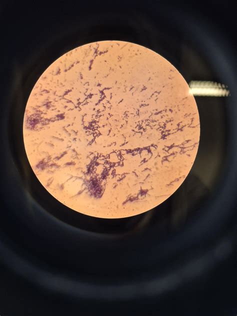 Gram stain of Bacillus mycoides : r/microbiology