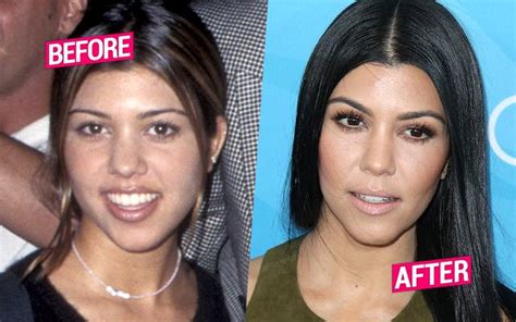 Kourtney Too?! Kardashian Had Surgery Like Her Sisters, Top Docs Claim