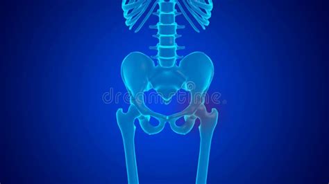 Blue Hologram Pain In The Femur Joint Caused By Cartilage Wear Stock