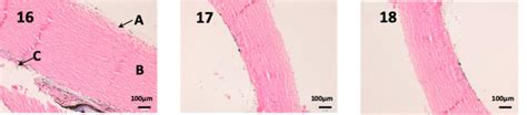 Sclera Histology Labeled