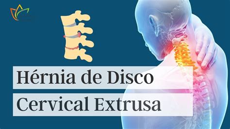 H Rnia De Disco Cervical Extrusa Youtube