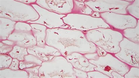 Polliondium of Funaria in Longitudinal Section Under Microscope 400x Against Bright Field Stock ...