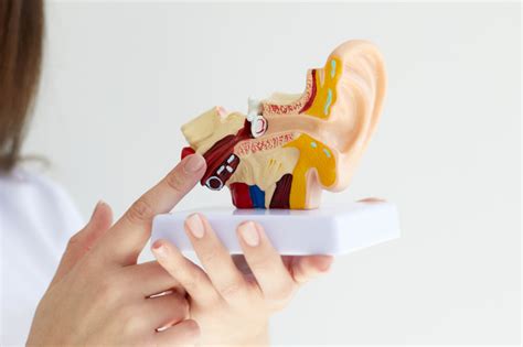 Ivrt Neuritis Vestibularis