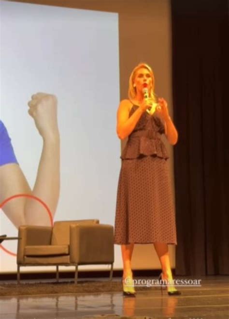 Ana Hickmann chora ao mostrar hematomas de agressões em palestra veja