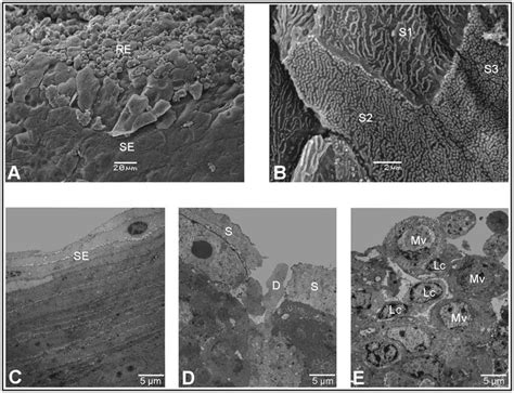 Ultramicroscopic views of the ovine palatine tonsil. A: The crypts of ...