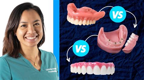 Dentures Vs Snap In Dentures Vs ALL On 4 Bridge YouTube