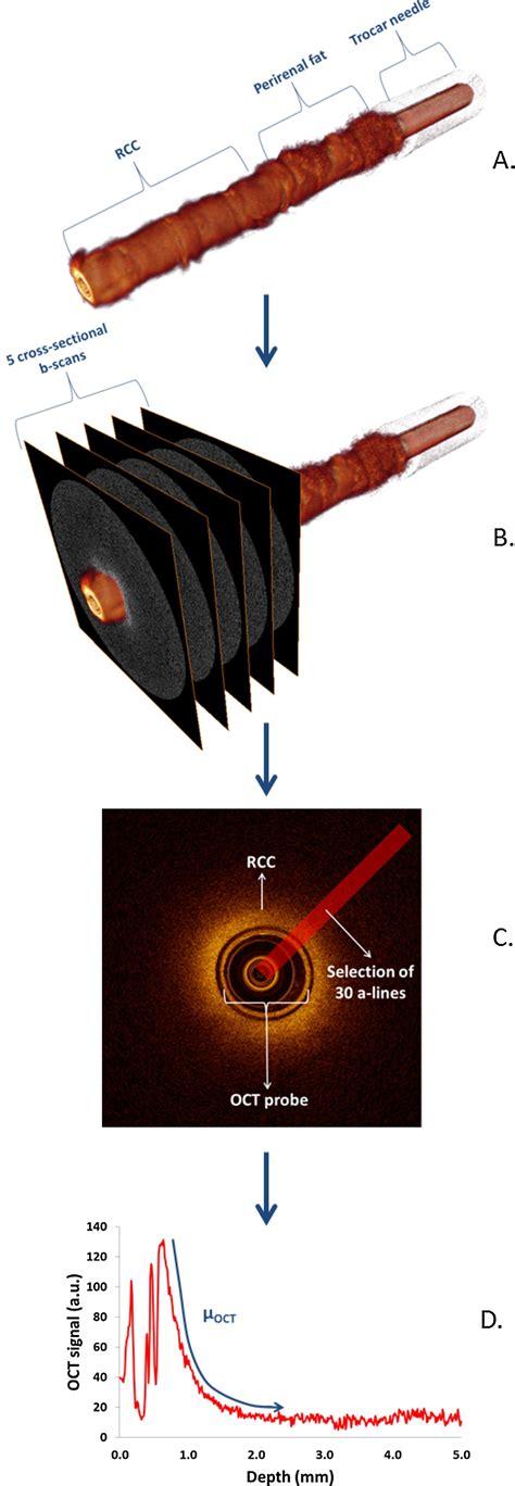 An In Vivo Prospective Study Of The Diagnostic Yield And Accuracy Of