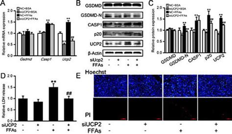 Genipin Reverses Hfd Induced Liver Damage And Inhibits Ucp2 Mediated